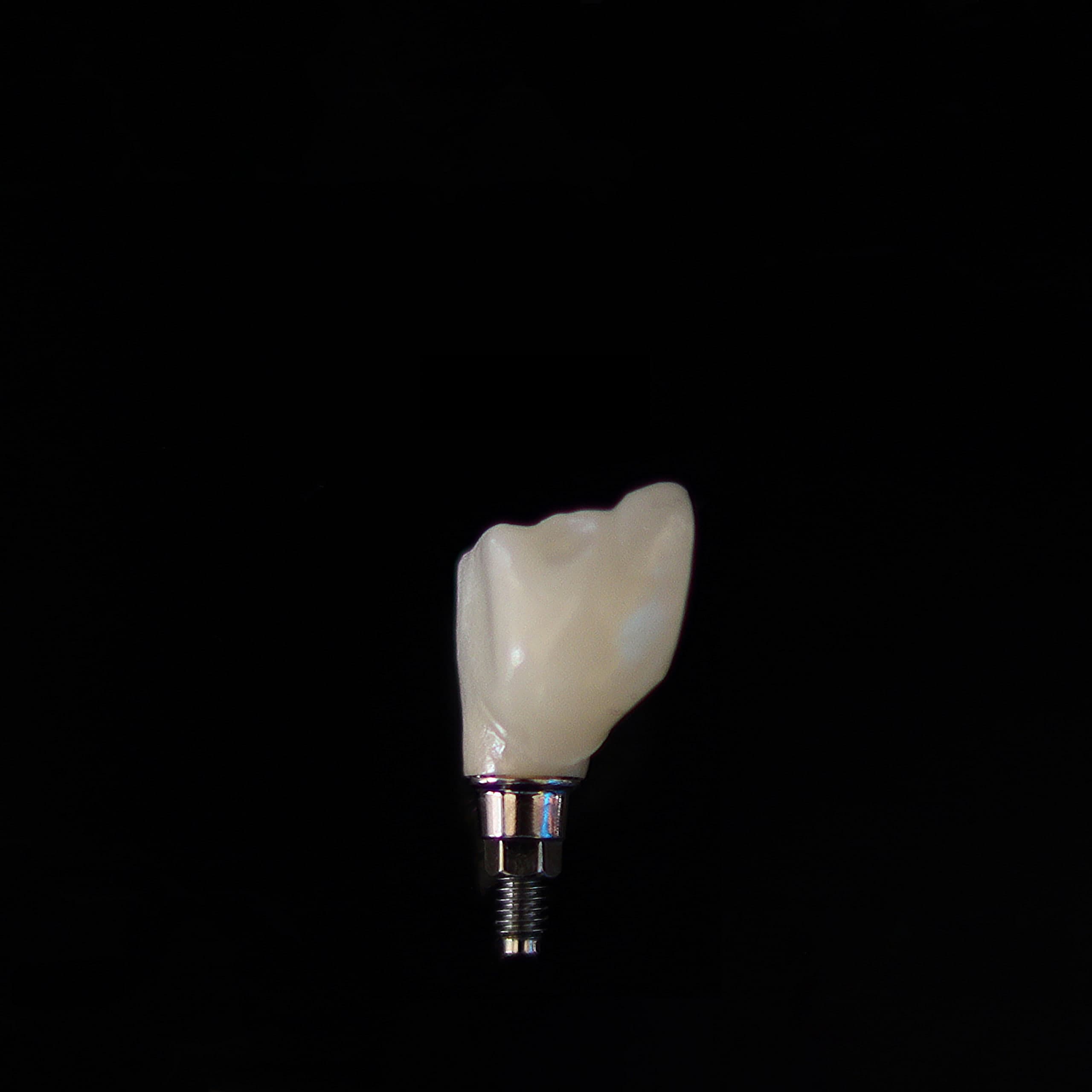 Ti-base üzerinde zirkonyum implant kron
